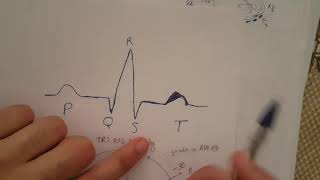 formation ECG  9 ECG NORMAL part 1 [upl. by Iralam410]