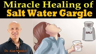 Miracle Healing of Salt Water Gargle  Dr Alan Mandell DC [upl. by Nodnahs]