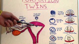 Formation of Twins  Embryology Video for Medical Students  USMLE Step 1 [upl. by Ledua]