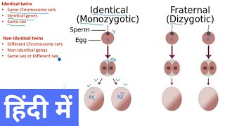 Types of Twins in Hindi [upl. by Vinia]