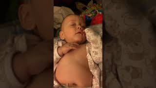 Example of Retractions Belly Breathing and Tachypnea in Infant [upl. by Westhead]