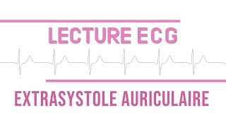 Interprétation ECG  Extrasystole Auriculaire quotESAquot [upl. by Grindle968]