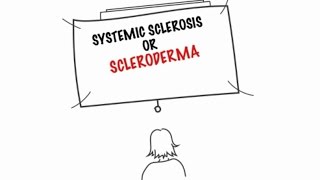 Understanding Multiple Sclerosis [upl. by Alo658]