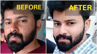 Get brighter skin Naturally in 2 Weeks  No side effects  Tamil  shadhikazeez [upl. by Hermina]