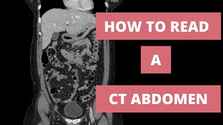 How to read a CT Abdomen for Med students and Residents  Part 1 [upl. by Thaddaus]