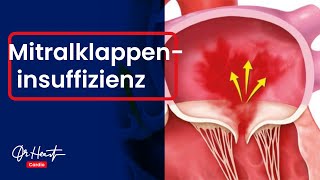 Mitralklappeninsuffizienz  einfach erklärt  DrHeart [upl. by Assenaj]