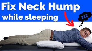 How to Fix Neck Hump While Sleeping [upl. by Arnulfo]