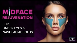 Under Eye and Midface Rejuvenation with Dermal Fillers at Mabrie Facial Institute [upl. by Nahtnahoj]