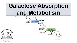 Metabolism of galactose Classic Galactosemia Galactokinase deficiency [upl. by Ravid]