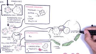 Systemic Lupus Erythematosus SLE  signs and symptoms pathophysiology investigations treatment [upl. by Emearg319]