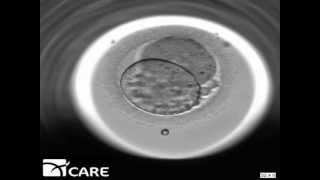 Time Lapse Embryo Imaging [upl. by Larok]