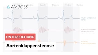 Aortenklappenstenose  Herzgeräusch  AMBOSS Video [upl. by Cairns299]