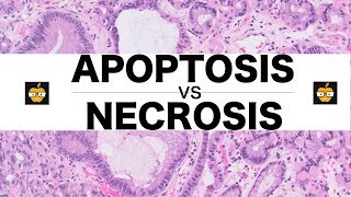 Apoptosis Intrinsic Extrinsic Pathways vs Necrosis [upl. by Ecydnak]