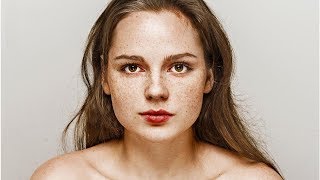 How to Grow Freckles Naturally and Safely [upl. by Eiramlatsyrc]