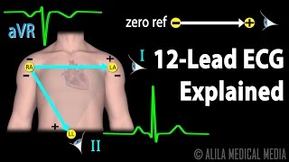 12 Lead ECG Explained Animation [upl. by Lopez]