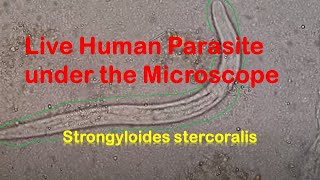 Human Parasites Live under the Microscope  Strongyloides stercoralis [upl. by Ialda]