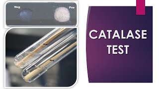 Catalase Test [upl. by Narat]