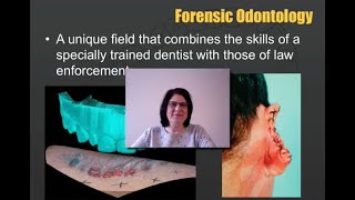 Forensic Odontology [upl. by Ramso689]