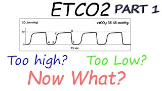 Capnography Waveform Interpretation Etco2 basics explained [upl. by Inohtna]