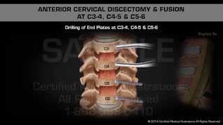 Major Ligaments of the Cervical Spine [upl. by Prudence]