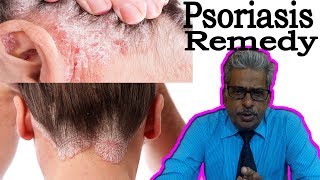 Psoriasis in Hindi  Discussion and Treatment in Homeopathy by Dr PS Tiwari [upl. by Siddra]