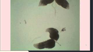 Drosophila Ovarian Dissection for Immunohistochemistry [upl. by Dnomsed]