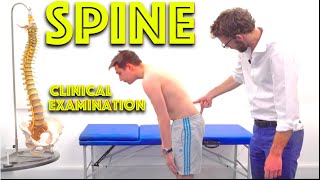 Spine Examination  Back Pain Assessment  4K  Clinical Skills  Dr Gill [upl. by Ditmore885]