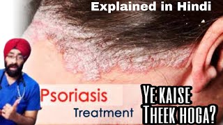 Psoriasis ka Safal ilaaj  Medical treatment  DrEducation [upl. by Afra]