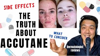 ACCUTANE  Dermatologist Review Unbiased [upl. by Braun]