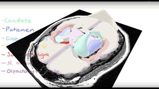 Basal Ganglia 3D Tour [upl. by Cassey]