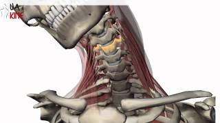 Cervical Laminectomy  Patient Education [upl. by Aral319]