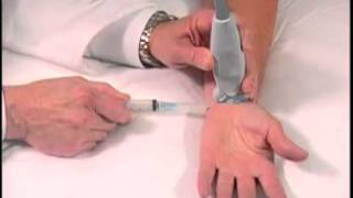 Carpal Tunnel Surgery  Everything You Need to Know [upl. by Ellehcir748]