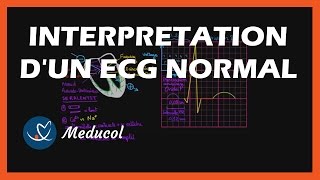 ECG Heart Rate Calculation  In 2 minutes  ECG Interpretation [upl. by Golightly]