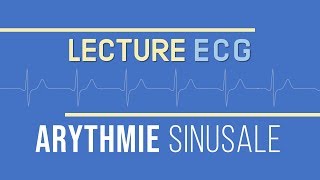 Interprétation ECG  Arythmie Sinusale [upl. by Notlil]