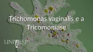 Parasitologia  Aula 07  Trichomonas vaginalis e a Tricomoníase [upl. by Rory]