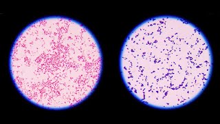 Staining technique in microbiology Gram staining [upl. by Florry]