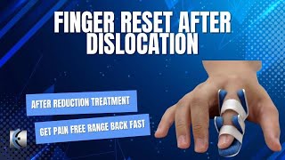 Finger Reset After Dislocation [upl. by Leroi]