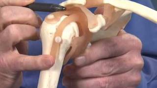 Shoulder Impingement  Dr Richard Hawkins [upl. by Shep501]