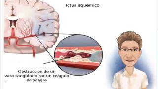 TRATAMIENTO DEL ICTUS ISQUÉMICO [upl. by Brade]