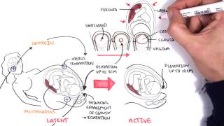 Obstetrics  Stages of Labour [upl. by Gearard461]