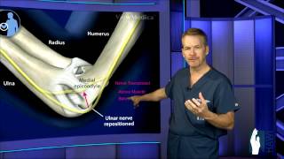 Cubital Tunnel Surgery [upl. by Bray]