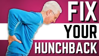 Top 10 Exercises to Stop Hunchback Kyphosis Forward Head Posture [upl. by Ecirtaemed882]