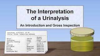 Interpretation of the Urinalysis Part 1  Introduction and Inspection [upl. by Dleifyar]