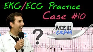 12 Lead ECG Practice Strip Interpretation  EKG Case 10 [upl. by Germaine]