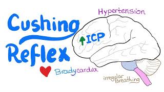 Cushing Reflex  Cushing Triad  Intracranial Hypertension  Emergency Medicine and EMS EMT [upl. by Sasnett]