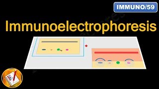 Immunoelectrophoresis FLImmuno59 [upl. by Avril]