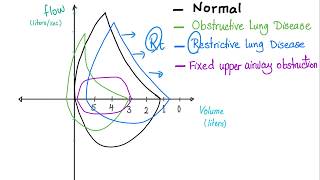 Flow Volume Loops  Respiratory Physiology  Pulmonary Medicine  Pulmonology Playlist [upl. by Robinette]